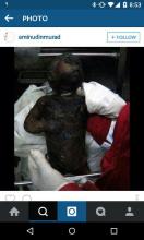 عکس/نوزادی که صهیونیست‌ها زنده سوزاندند(18+) 